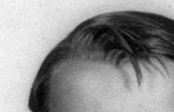 cowlick